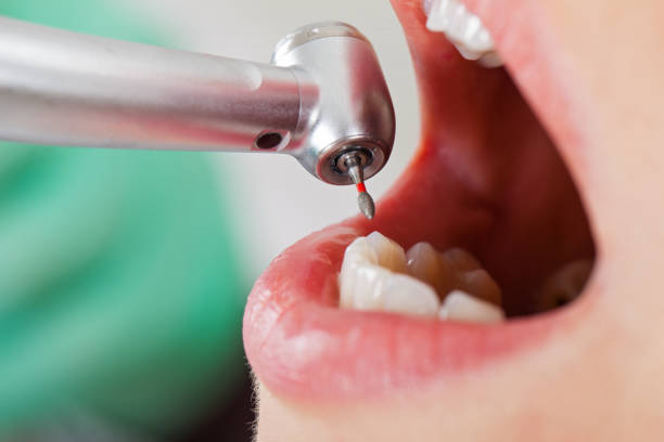 Best Pediatric Emergency Dentist in Frontenac, MO